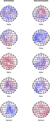 Estimated EEG functional connectivity and aperiodic component induced by vagal nerve stimulation in patients with drug-resistant epilepsy